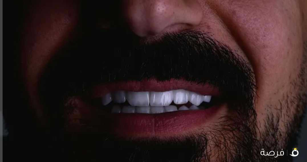 ابتسامة هوليود ايماكس3d عاليه الشفافية