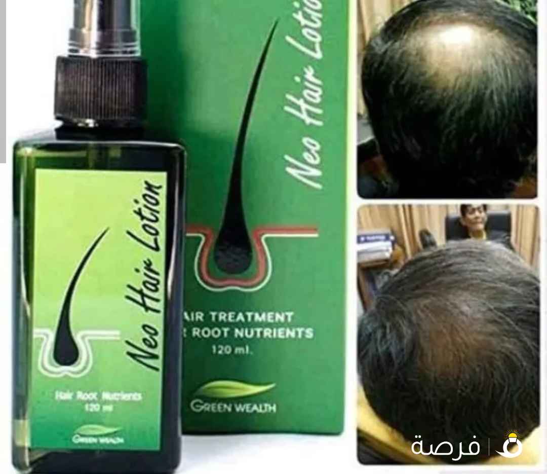نيو هاير لوشن السحري لانبات الشعر وعلاج الصلع