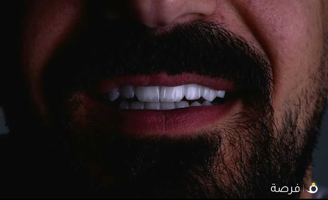 ابتسامة هوليود ايماكس3d عاليه الشفافية