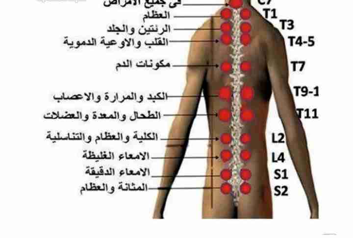 الفوطه الناريه الطب الصيني القديم/ الحجامه